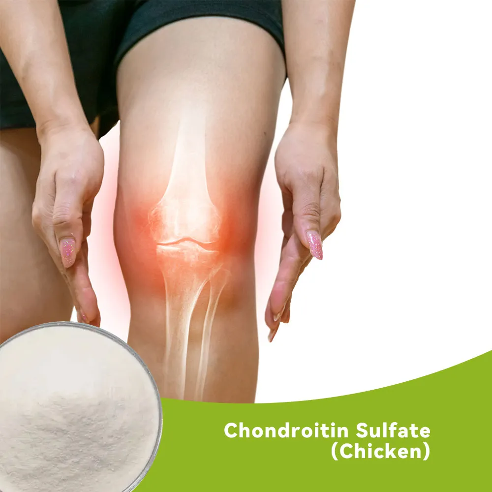 Chondroitin Sulfate